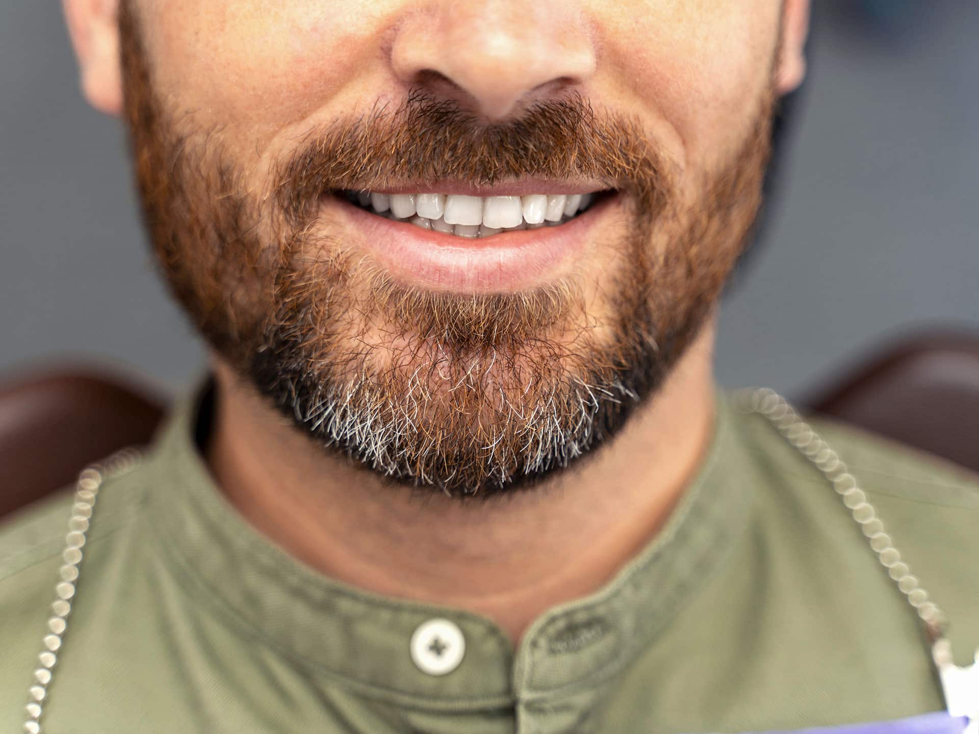 Close up of a bearded man's teeth up at timber ridge dental center dental appointment